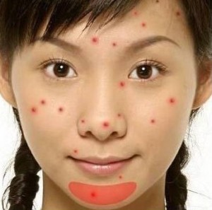 反孔战痘(8):抗痘误区–真魅博客