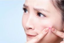 成人痘痘肌的彩妆与卸妆方案–真魅博客