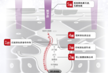 听说,你用美白产品后斑反而变多了?–真魅博客