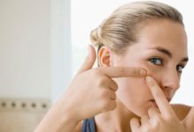 长知识!关于成人痘最全面的解决方案–真魅博客