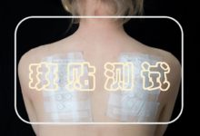 斑贴测试可以预测痘痘的产生吗?–真魅博客