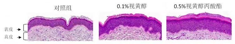 视黄醇丙酸酯(RP)