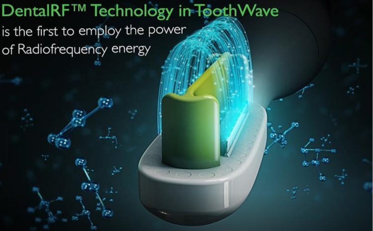 silk'n tooth wave电动牙刷