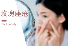 玫瑰痤疮女性更严重,但可试试壬二酸产品–真魅博客